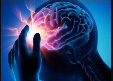 Seizure Disorder